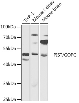GOPC Rabbit Polyclonal Antibody