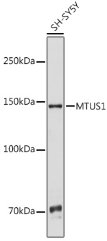 MTUS1 Rabbit Polyclonal Antibody