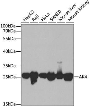 AK4 Rabbit Polyclonal Antibody