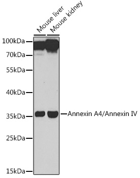 ANXA4 Rabbit Polyclonal Antibody