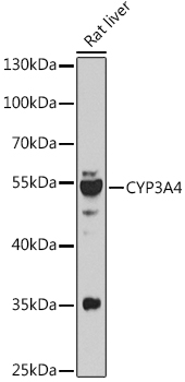 CYP3A4 Rabbit Polyclonal Antibody