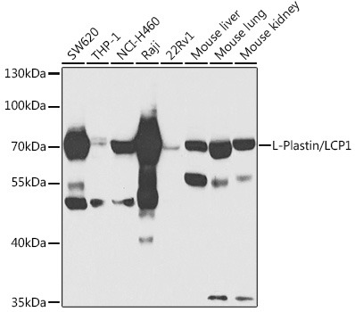 LCP1 Rabbit Polyclonal Antibody