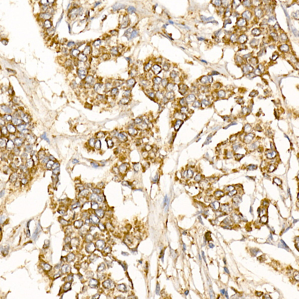 PHB Rabbit Polyclonal Antibody