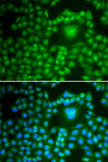 PPP1CB Rabbit Polyclonal Antibody