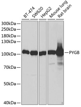 PYGB Rabbit Polyclonal Antibody