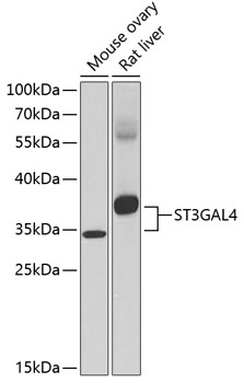 ST3GAL4 Rabbit Polyclonal Antibody
