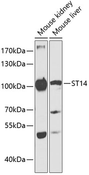 ST14 Rabbit Polyclonal Antibody