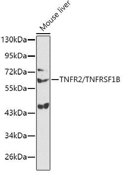 TNFRSF1B Rabbit Polyclonal Antibody