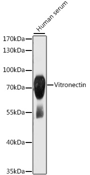 VTN Rabbit Polyclonal Antibody