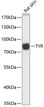 TYR Rabbit Polyclonal Antibody