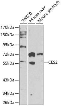CES2 Rabbit Polyclonal Antibody
