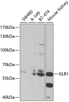 GLB1 Rabbit Polyclonal Antibody