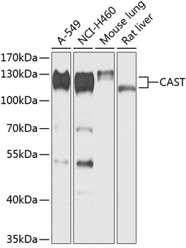 CAST Rabbit Polyclonal Antibody