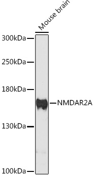 GRIN2A Rabbit Polyclonal Antibody