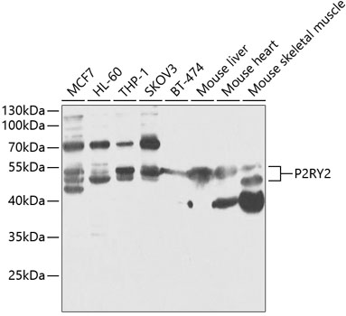 P2RY2 Rabbit Polyclonal Antibody