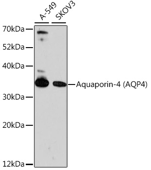 Aquaporin 4 Rabbit Polyclonal Antibody