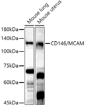 MCAM Rabbit Polyclonal Antibody