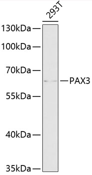 PAX3 Rabbit Polyclonal Antibody