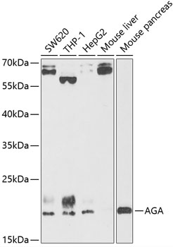 AGA Rabbit Polyclonal Antibody