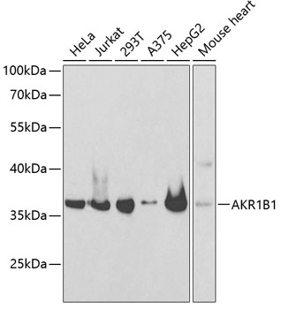AKR1B1 Rabbit Polyclonal Antibody