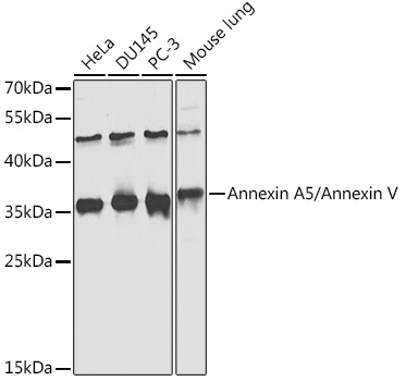 ANXA5 Rabbit Polyclonal Antibody