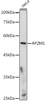 AP2M1 Rabbit Polyclonal Antibody