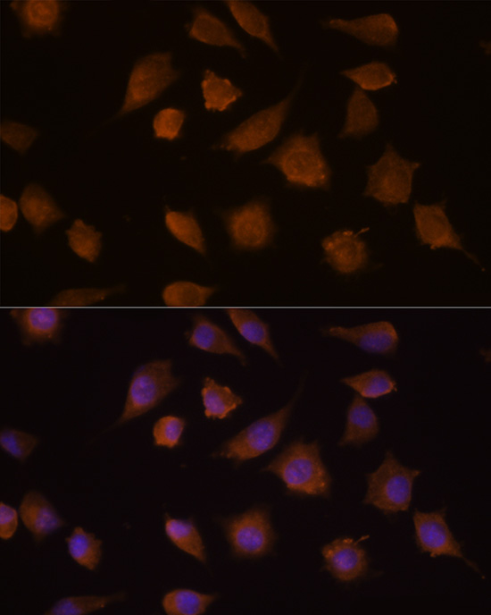 COMP Rabbit Polyclonal Antibody