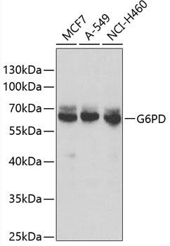 G6PD Rabbit Polyclonal Antibody