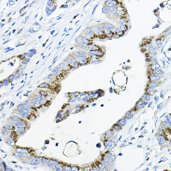 GALNT3 Rabbit Polyclonal Antibody