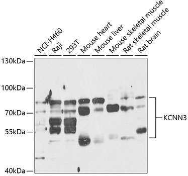 KCNN3 Rabbit Polyclonal Antibody