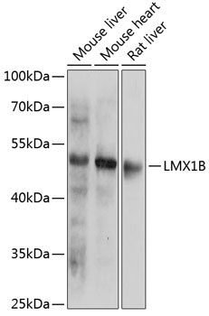 LMX1B Rabbit Polyclonal Antibody