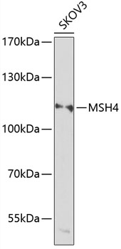 MSH4 Rabbit Polyclonal Antibody
