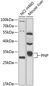 PNP Rabbit Polyclonal Antibody