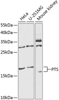 PTS Rabbit Polyclonal Antibody