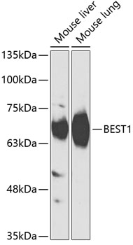 BEST1 Rabbit Polyclonal Antibody