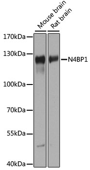 N4BP1 Rabbit Polyclonal Antibody
