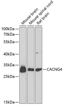 CACNG4 Rabbit Polyclonal Antibody