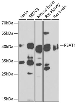 PSAT1 Rabbit Polyclonal Antibody