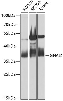 GNAI2 Rabbit Polyclonal Antibody
