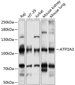 ATP2A3 Rabbit Polyclonal Antibody