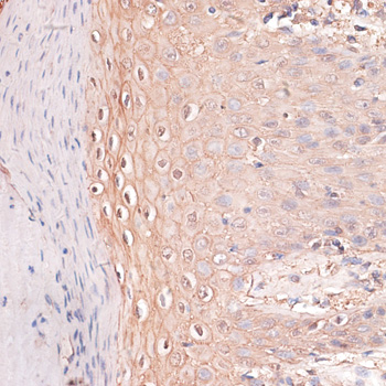 CDH3 Rabbit Polyclonal Antibody