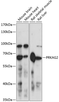 PRKAG2 Rabbit Polyclonal Antibody