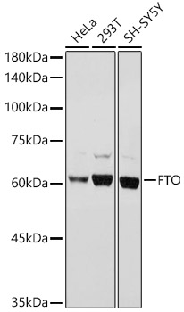 FTO Rabbit Polyclonal Antibody