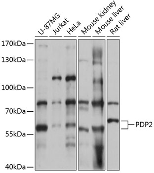 PDP2 Rabbit Polyclonal Antibody