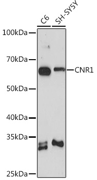 CNR1 Rabbit Polyclonal Antibody