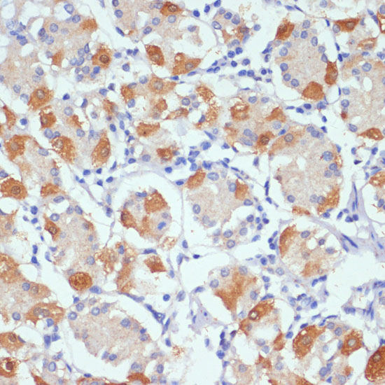 AHR Rabbit Polyclonal Antibody