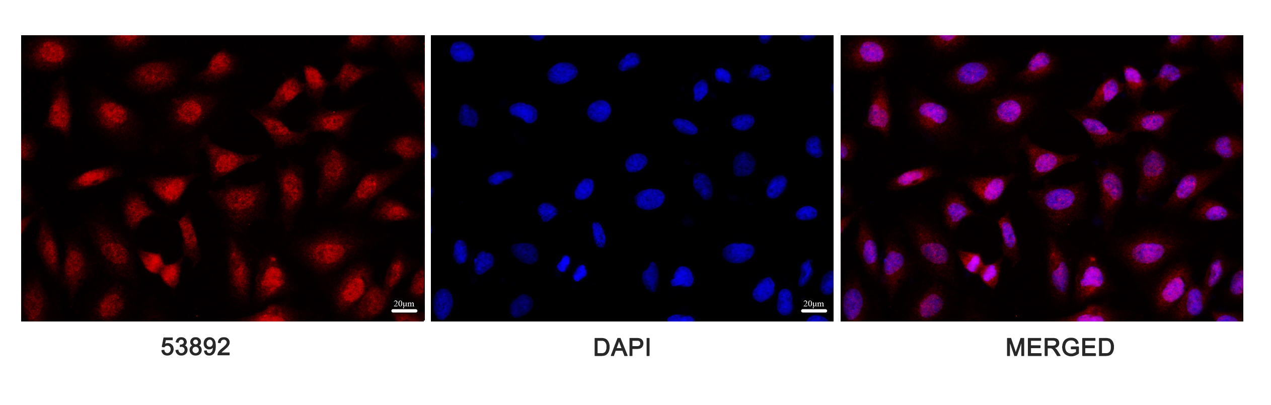 XBP1 Rabbit Polyclonal Antibody
