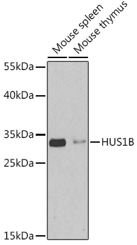 HUS1B Rabbit Polyclonal Antibody