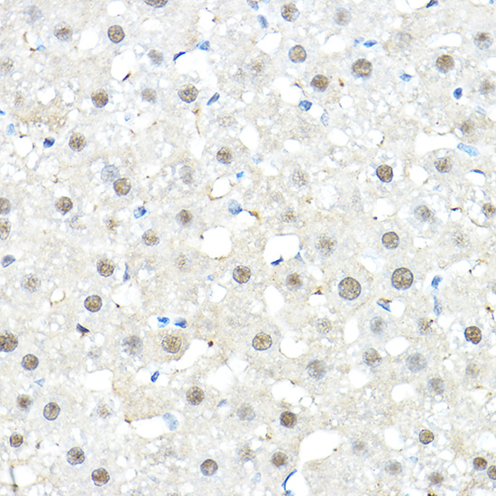 SP1 Rabbit Polyclonal Antibody