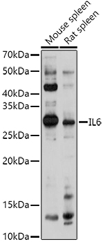 IL6 Rabbit Polyclonal Antibody